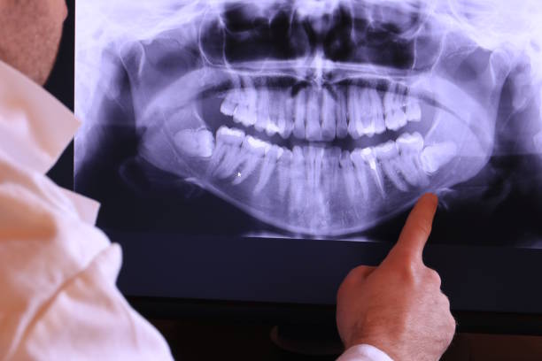 Best Same-Day Emergency Dentist in Annapolis Neck, MD