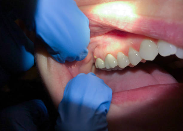 Best Weekend Emergency Dentist in Annapolis Neck, MD